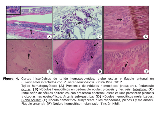 Histopathological Analysis In Litopenaeus Vannamei Infected With Vibrio 